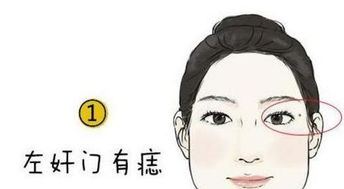 痣的位置与命运图解