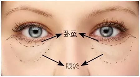 眼下有卧蚕女人财运旺