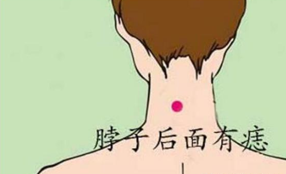 看痣相：什么样的痣可以点？点痣会影响一个人的运气吗