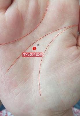 男性右手背长痣各方面的影响