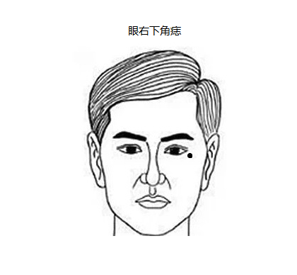 眼右下角痣