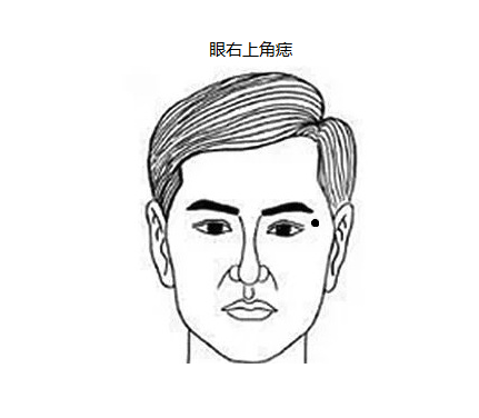 眼右上角痣