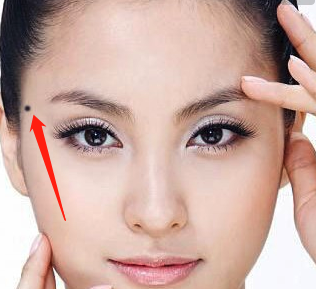 能赚钱暴富的痣长在哪