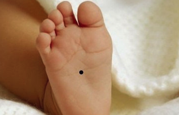 旺财的痣长在哪