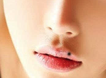 女人嘴唇长痣好不好