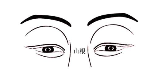 山根有痣婚姻好不好如何化解
