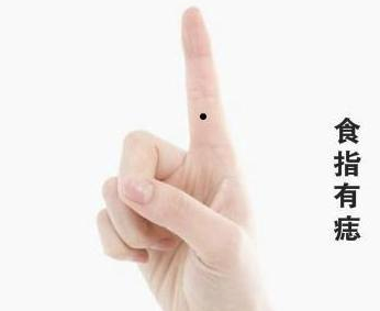 食指长痣有什么含义