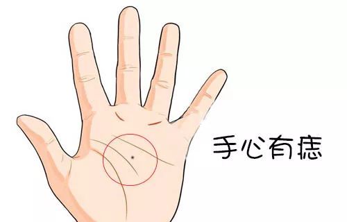 手掌有痣代表着什么