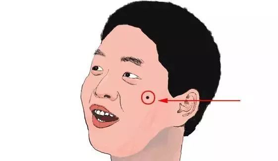 颧骨有痣