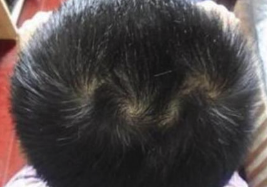 头上几个旋好