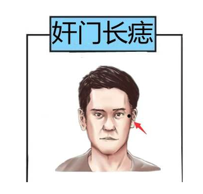 奸门有痣克妻