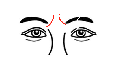 眉毛中间八字纹