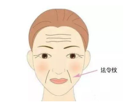 法令纹