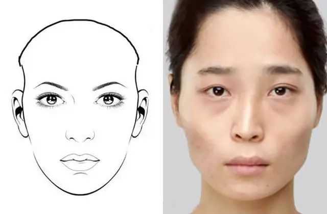 太阳穴凹陷不好看