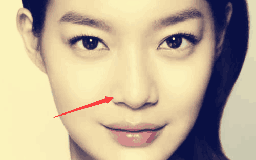 鼻头有肉的女人面相