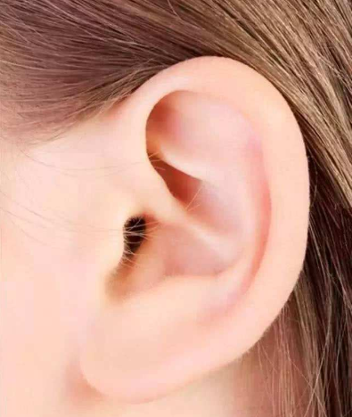 耳朵最重要的是看颜色